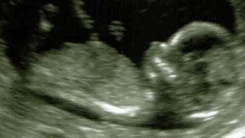 Racing Pregnant & Qualifying for Millrose